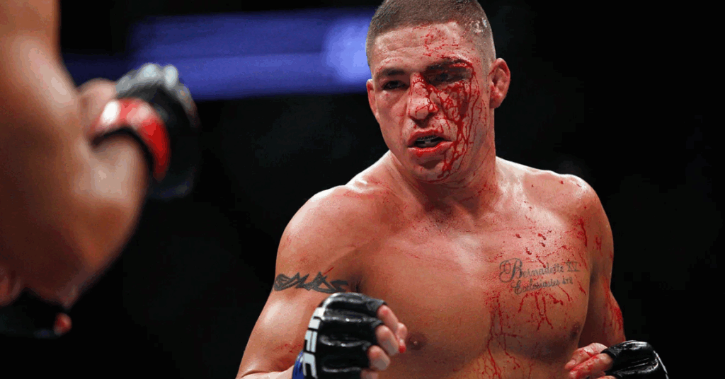 Diego Sanchez correct